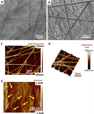 Electrospun Nanofiber Meshes With Endometrial MSCs Modulate Foreign Body Response by Increased Angiogenesis, Matrix Synthesis, and Anti-Inflammatory Gene Expression in Mice: Implication in Pelvic Floor